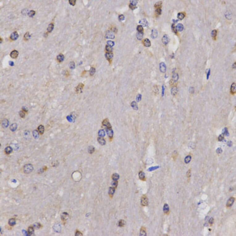 Anti-FANCD2 Antibody from Bioworld Technology (BS6604) - Antibodies.com