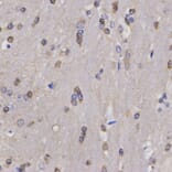 Anti-FANCD2 Antibody from Bioworld Technology (BS6604) - Antibodies.com