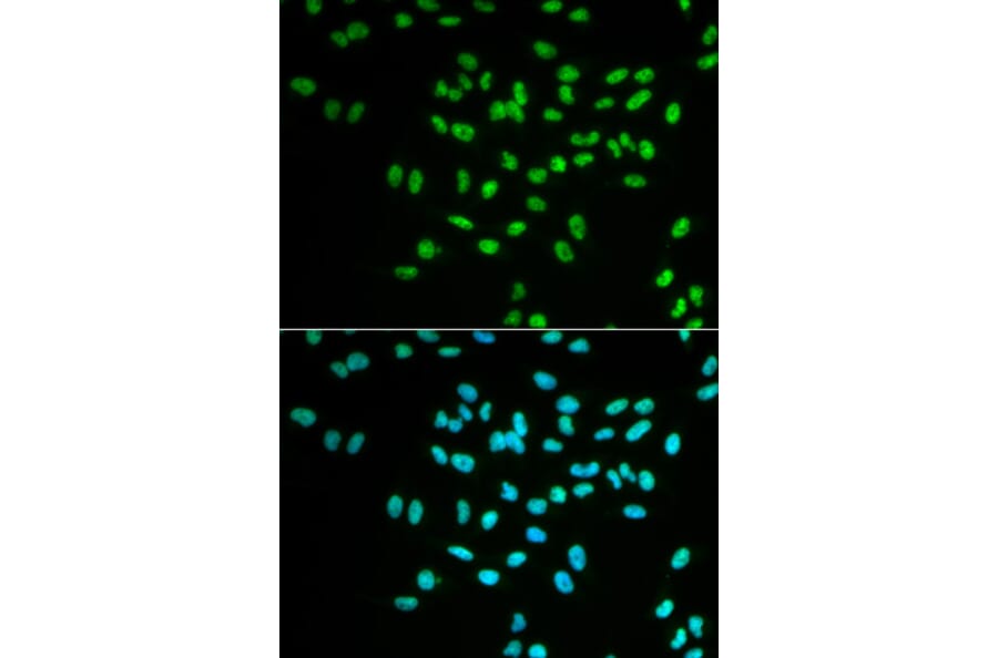 Anti-FANCD2 Antibody from Bioworld Technology (BS6604) - Antibodies.com