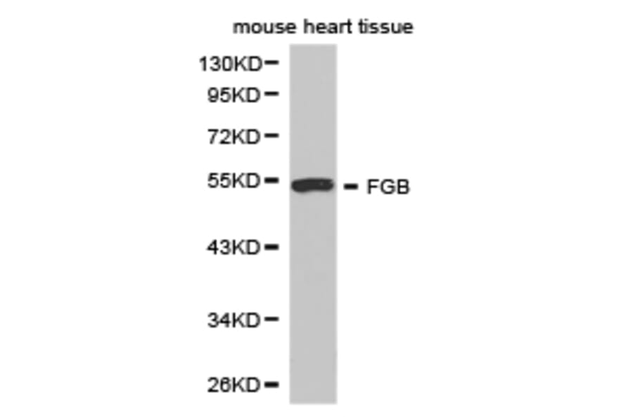 Anti-Fibrinogen β / FGB Antibody from Bioworld Technology (BS6607) - Antibodies.com