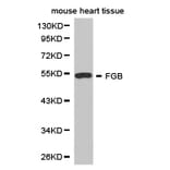 Anti-Fibrinogen β / FGB Antibody from Bioworld Technology (BS6607) - Antibodies.com
