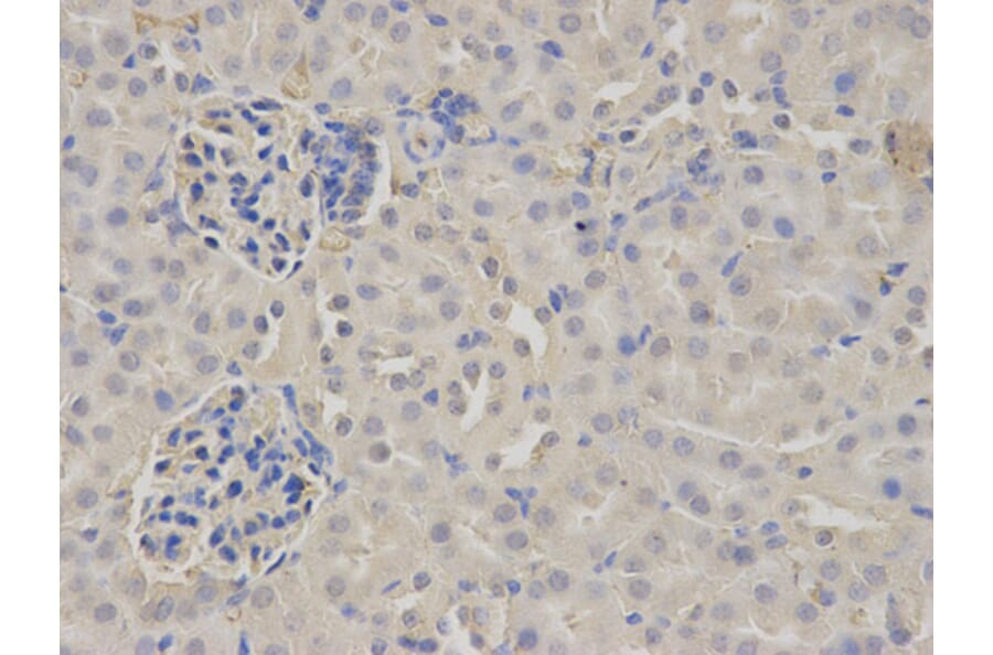 Anti-Fibrinogen β / FGB Antibody from Bioworld Technology (BS6607) - Antibodies.com