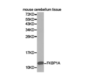 Anti-FKBP1A Antibody from Bioworld Technology (BS6608) - Antibodies.com
