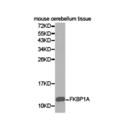 Anti-FKBP1A Antibody from Bioworld Technology (BS6608) - Antibodies.com