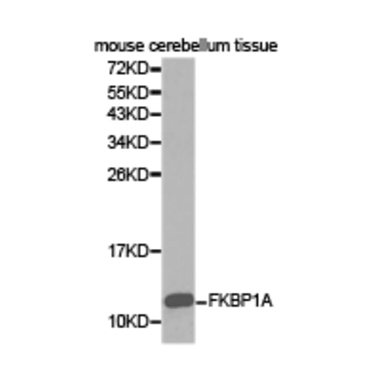 Anti-FKBP1A Antibody from Bioworld Technology (BS6608) - Antibodies.com