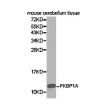 Anti-FKBP1A Antibody from Bioworld Technology (BS6608) - Antibodies.com