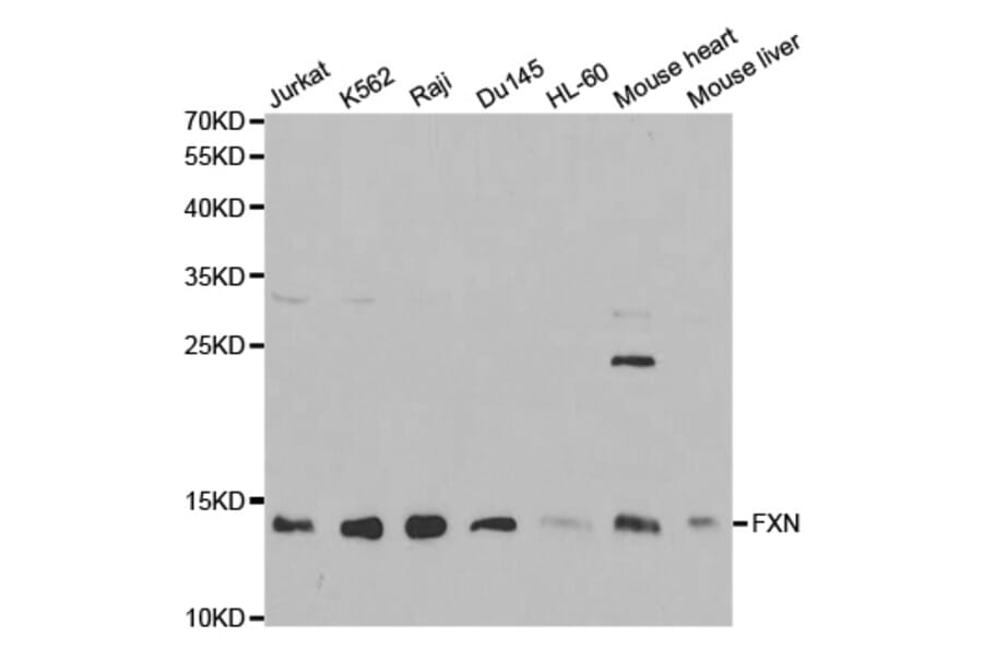 Anti-FXN Antibody from Bioworld Technology (BS6609) - Antibodies.com