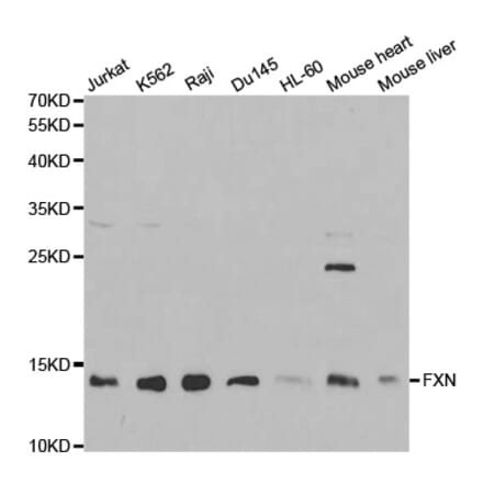 Anti-FXN Antibody from Bioworld Technology (BS6609) - Antibodies.com
