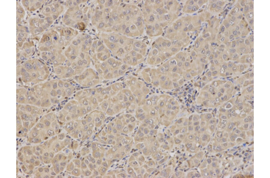 Anti-FXN Antibody from Bioworld Technology (BS6609) - Antibodies.com