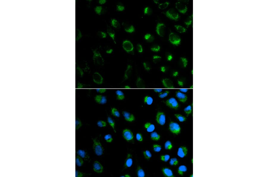 Anti-FXN Antibody from Bioworld Technology (BS6609) - Antibodies.com