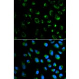 Anti-FXN Antibody from Bioworld Technology (BS6609) - Antibodies.com