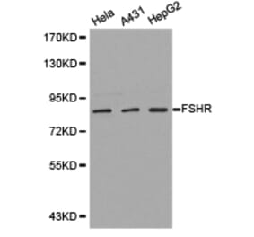Anti-FSHR Antibody from Bioworld Technology (BS6610) - Antibodies.com