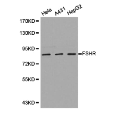 Anti-FSHR Antibody from Bioworld Technology (BS6610) - Antibodies.com