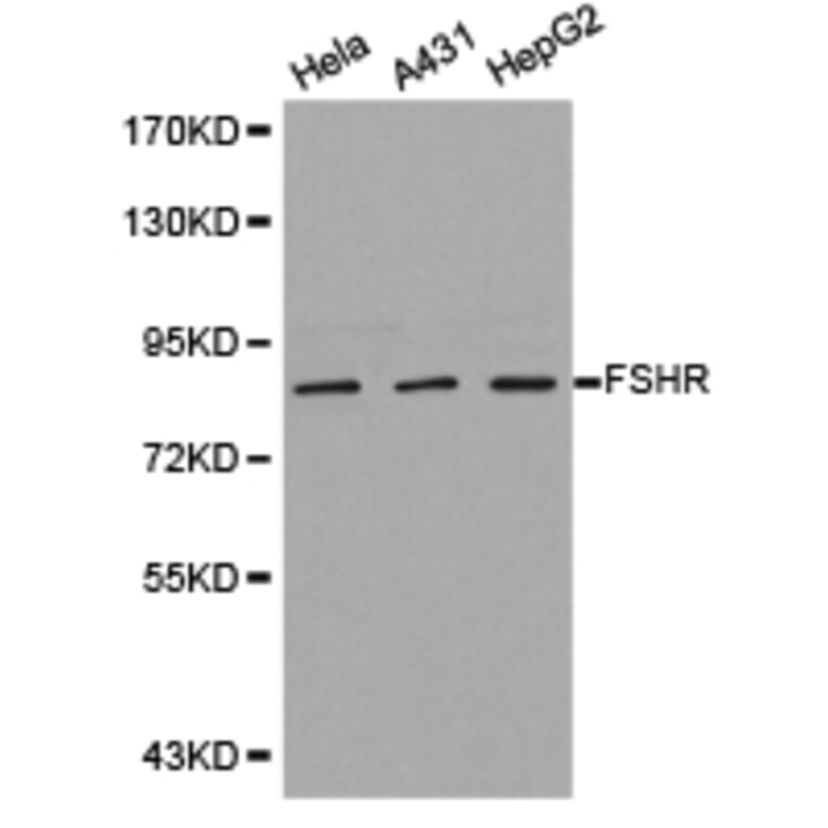 Anti-FSHR Antibody from Bioworld Technology (BS6610) - Antibodies.com