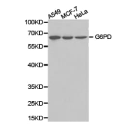 Anti-G6PD Antibody from Bioworld Technology (BS6611) - Antibodies.com