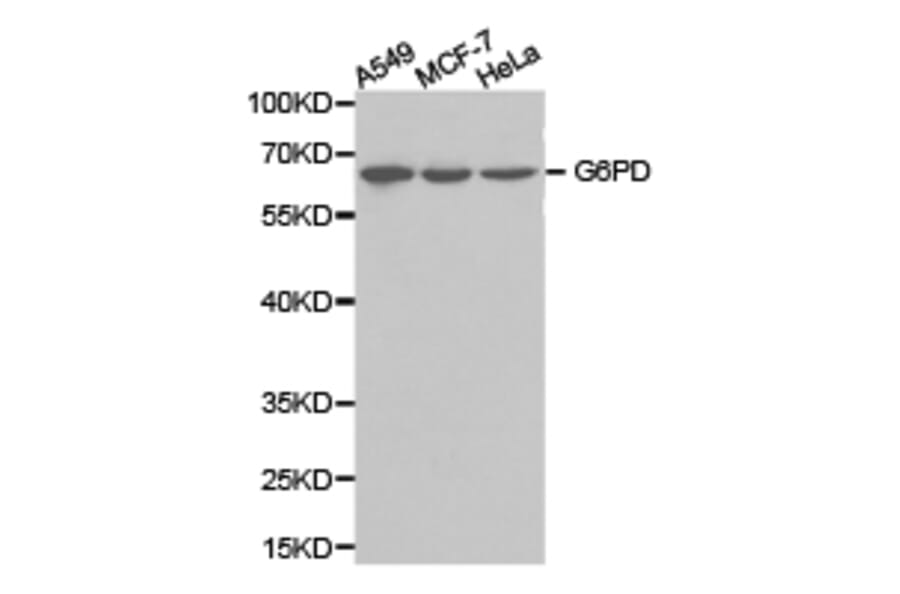 Anti-G6PD Antibody from Bioworld Technology (BS6611) - Antibodies.com