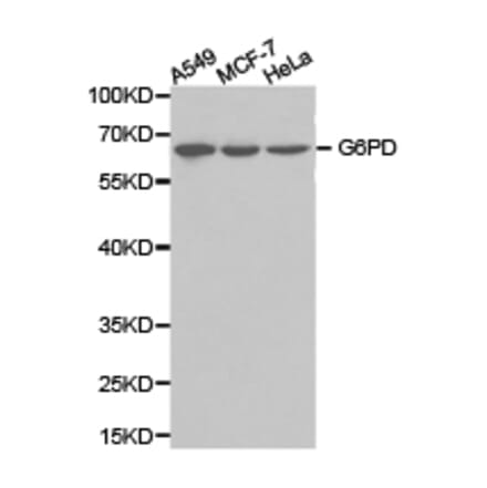 Anti-G6PD Antibody from Bioworld Technology (BS6611) - Antibodies.com