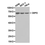 Anti-G6PD Antibody from Bioworld Technology (BS6611) - Antibodies.com