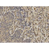 Anti-G6PD Antibody from Bioworld Technology (BS6611) - Antibodies.com