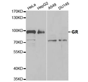 Anti-GR Antibody from Bioworld Technology (BS6617) - Antibodies.com