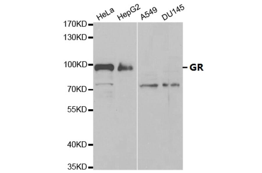 Anti-GR Antibody from Bioworld Technology (BS6617) - Antibodies.com