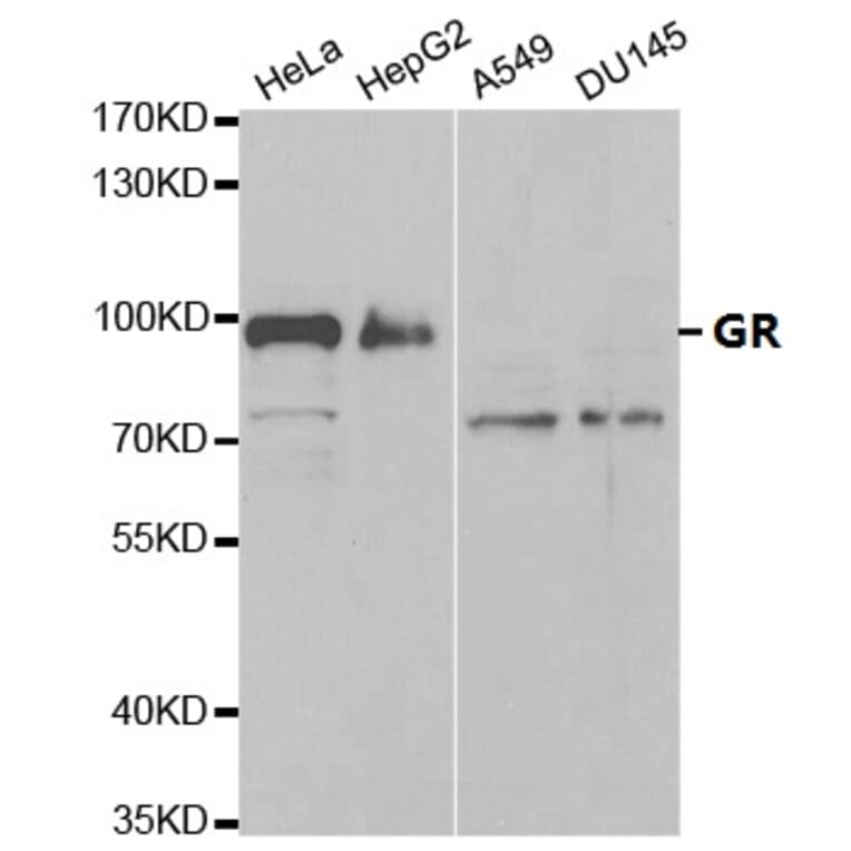Anti-GR Antibody from Bioworld Technology (BS6617) - Antibodies.com