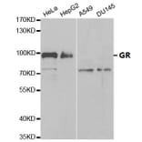 Anti-GR Antibody from Bioworld Technology (BS6617) - Antibodies.com