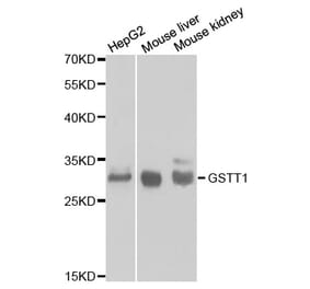 Anti-GSTT1 Antibody from Bioworld Technology (BS6618) - Antibodies.com