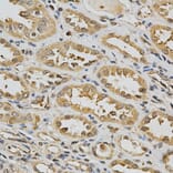 Anti-GSTT1 Antibody from Bioworld Technology (BS6618) - Antibodies.com