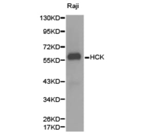 Anti-HCK Antibody from Bioworld Technology (BS6620) - Antibodies.com