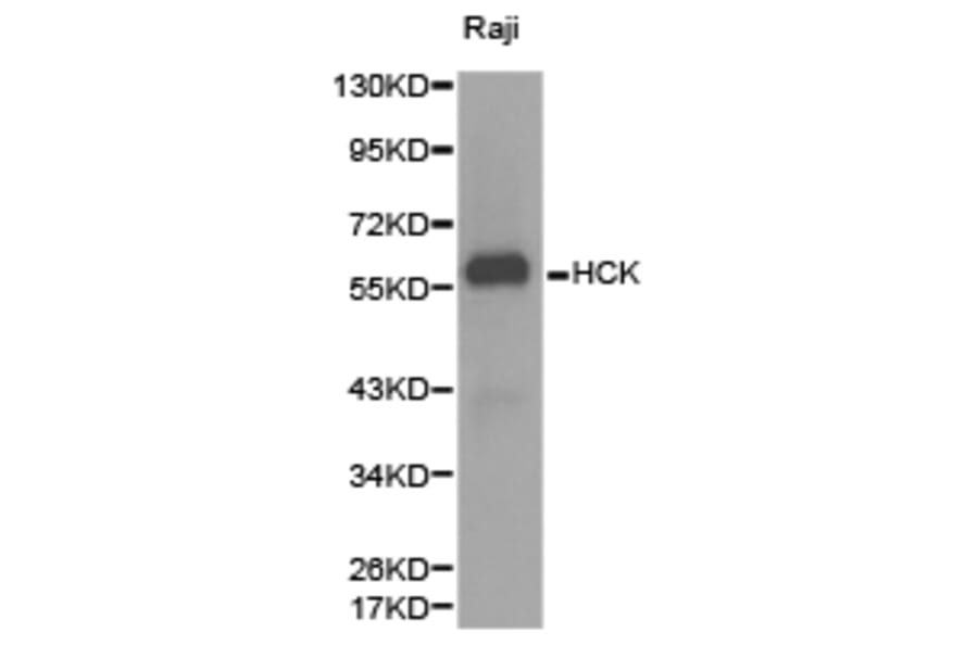 Anti-HCK Antibody from Bioworld Technology (BS6620) - Antibodies.com