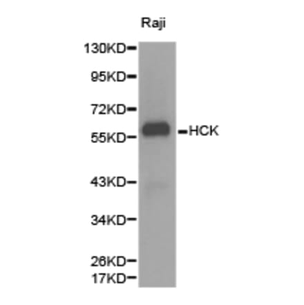 Anti-HCK Antibody from Bioworld Technology (BS6620) - Antibodies.com
