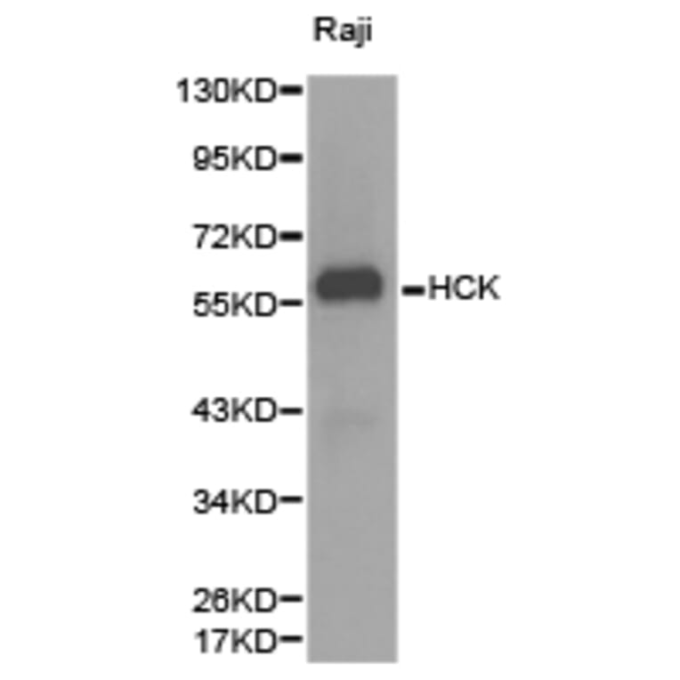 Anti-HCK Antibody from Bioworld Technology (BS6620) - Antibodies.com