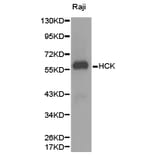 Anti-HCK Antibody from Bioworld Technology (BS6620) - Antibodies.com