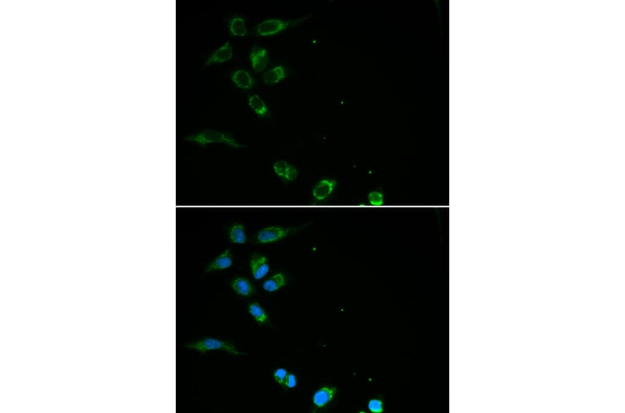 Anti-HFE Antibody from Bioworld Technology (BS6621) - Antibodies.com