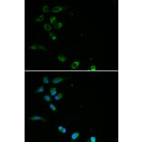 Anti-HFE Antibody from Bioworld Technology (BS6621) - Antibodies.com