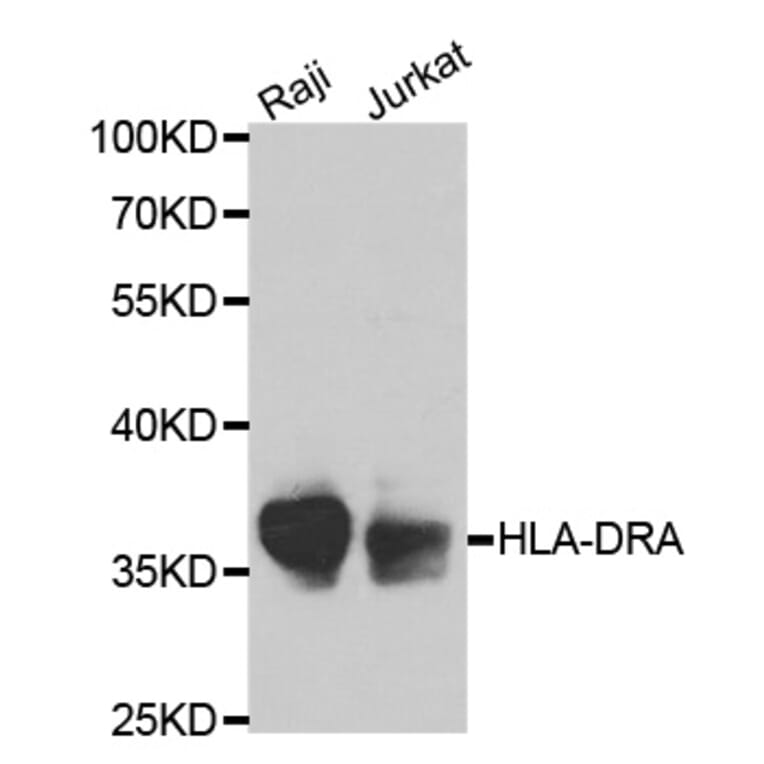 Anti-HLA-DRA Antibody from Bioworld Technology (BS6622) - Antibodies.com