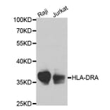 Anti-HLA-DRA Antibody from Bioworld Technology (BS6622) - Antibodies.com