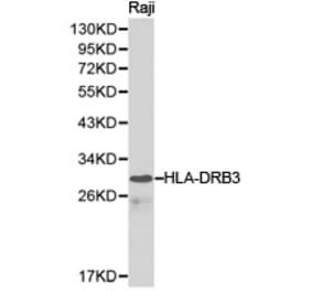 Anti-HLA-DRB3 Antibody from Bioworld Technology (BS6623) - Antibodies.com