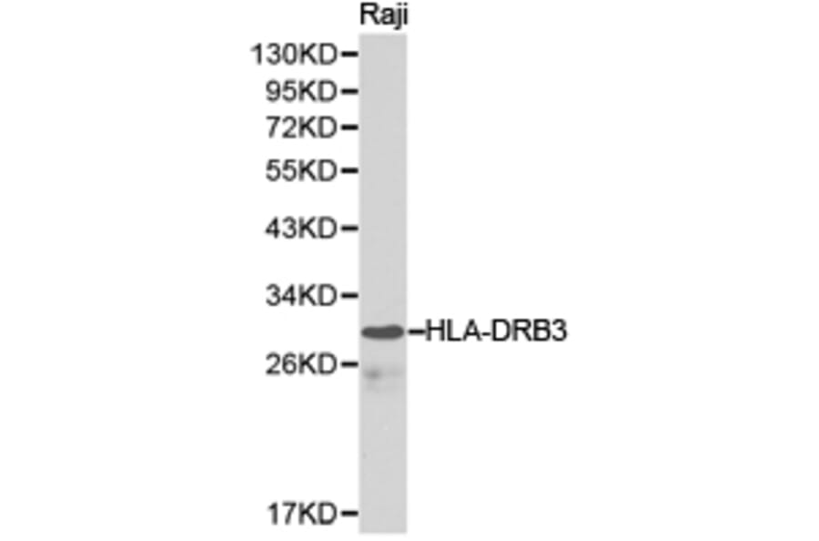Anti-HLA-DRB3 Antibody from Bioworld Technology (BS6623) - Antibodies.com