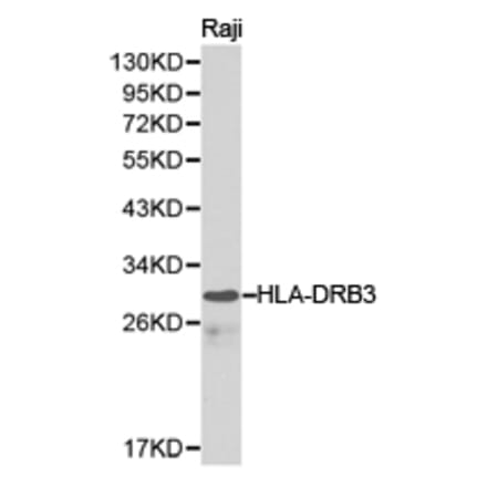 Anti-HLA-DRB3 Antibody from Bioworld Technology (BS6623) - Antibodies.com