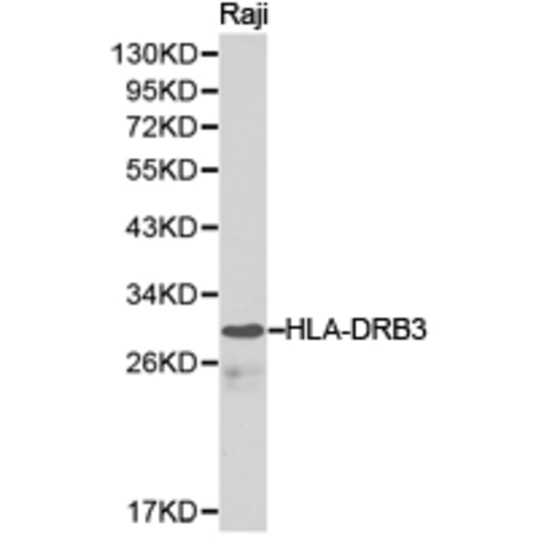 Anti-HLA-DRB3 Antibody from Bioworld Technology (BS6623) - Antibodies.com