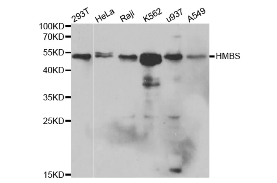 Anti-HMBS Antibody from Bioworld Technology (BS6624) - Antibodies.com