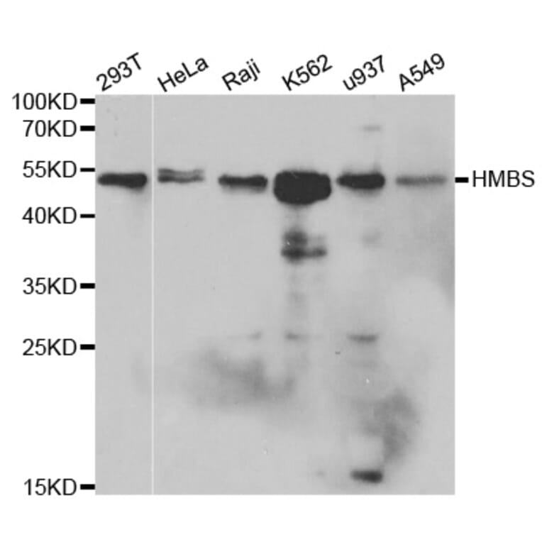 Anti-HMBS Antibody from Bioworld Technology (BS6624) - Antibodies.com