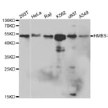 Anti-HMBS Antibody from Bioworld Technology (BS6624) - Antibodies.com
