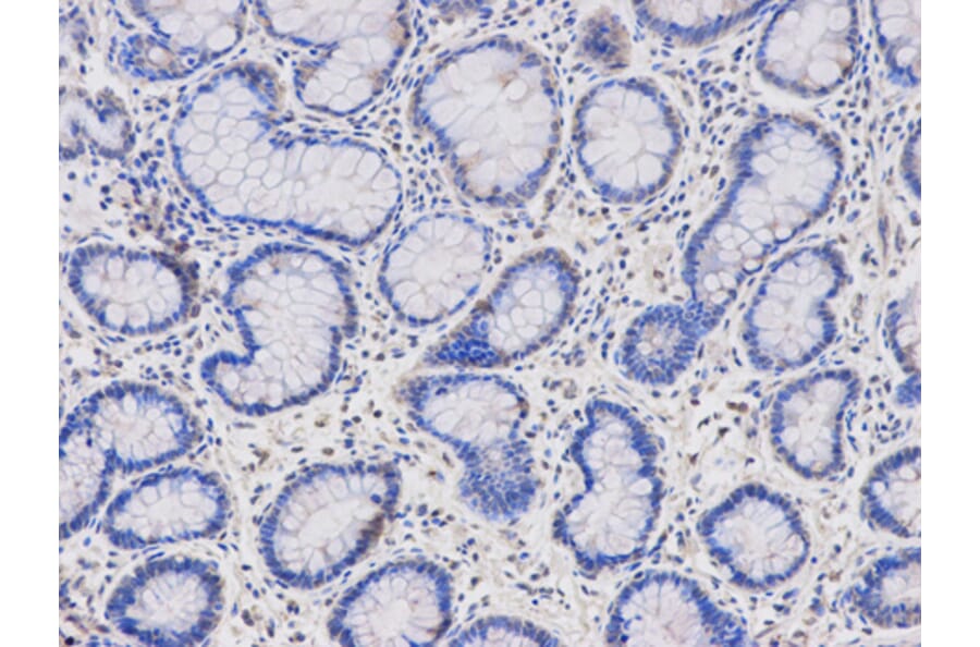 Anti-HMBS Antibody from Bioworld Technology (BS6624) - Antibodies.com