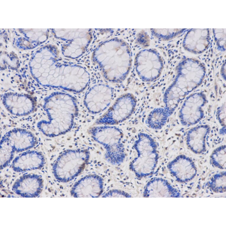 Anti-HMBS Antibody from Bioworld Technology (BS6624) - Antibodies.com