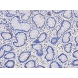 Anti-HMBS Antibody from Bioworld Technology (BS6624) - Antibodies.com