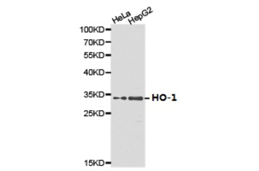 Anti-HO-1 Antibody from Bioworld Technology (BS6626) - Antibodies.com