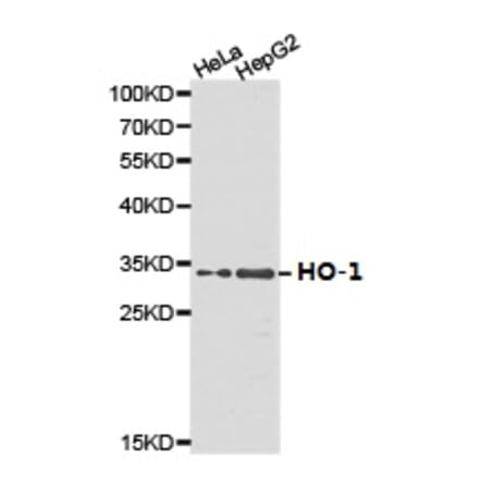 Anti-HO-1 Antibody from Bioworld Technology (BS6626) - Antibodies.com